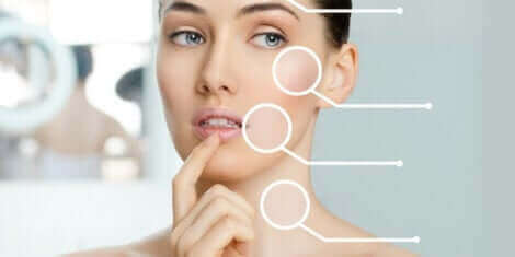 Le Soft Lift s'emploie pour lutter contre le vieillissement de la peau.
