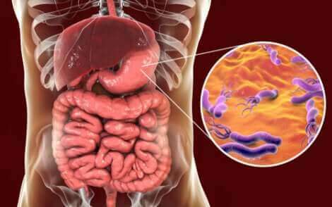 Helicobacter pylori et le cancer  sontils liés ?  Améliore ta Santé