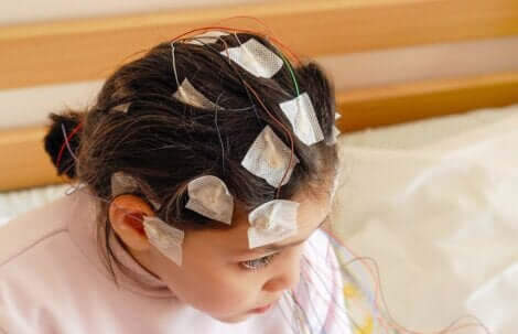 Il existe divers traitements visant à faire face à l'épilepsie infantile.