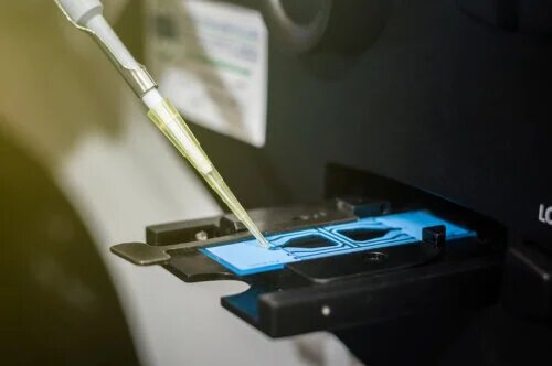 Comment interpréter les résultats d'un spermogramme