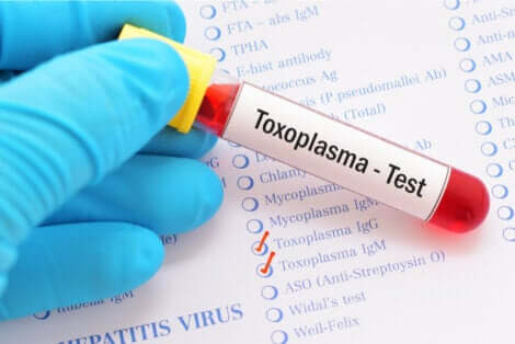 Le test sérologique permet de diagnostiquer une toxoplasmose oculaire.