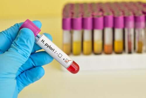 Analyse h. pylori.