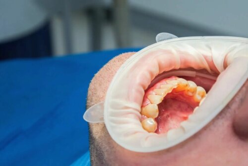 Une bouche chez un dentiste.
