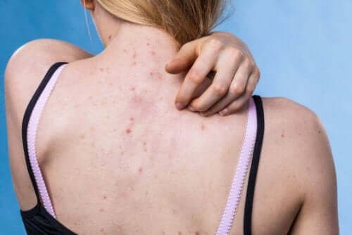 Conseils pour prévenir les maladies de peau