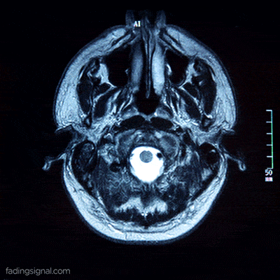 Un cerveau en images.