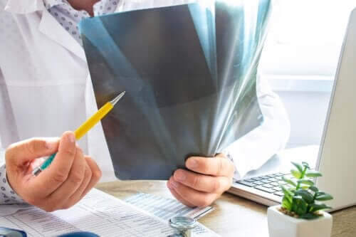 Tout ce que vous devez savoir sur l'oedème osseux