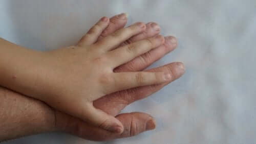 Acromégalie : qu'est-ce que c'est et quels sont ses symptômes ?