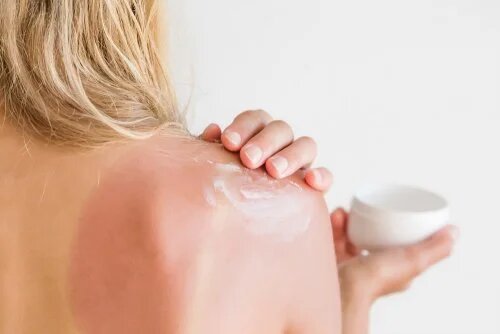 Pour éviter les coups de soleil, pensez à mettre de la crème.