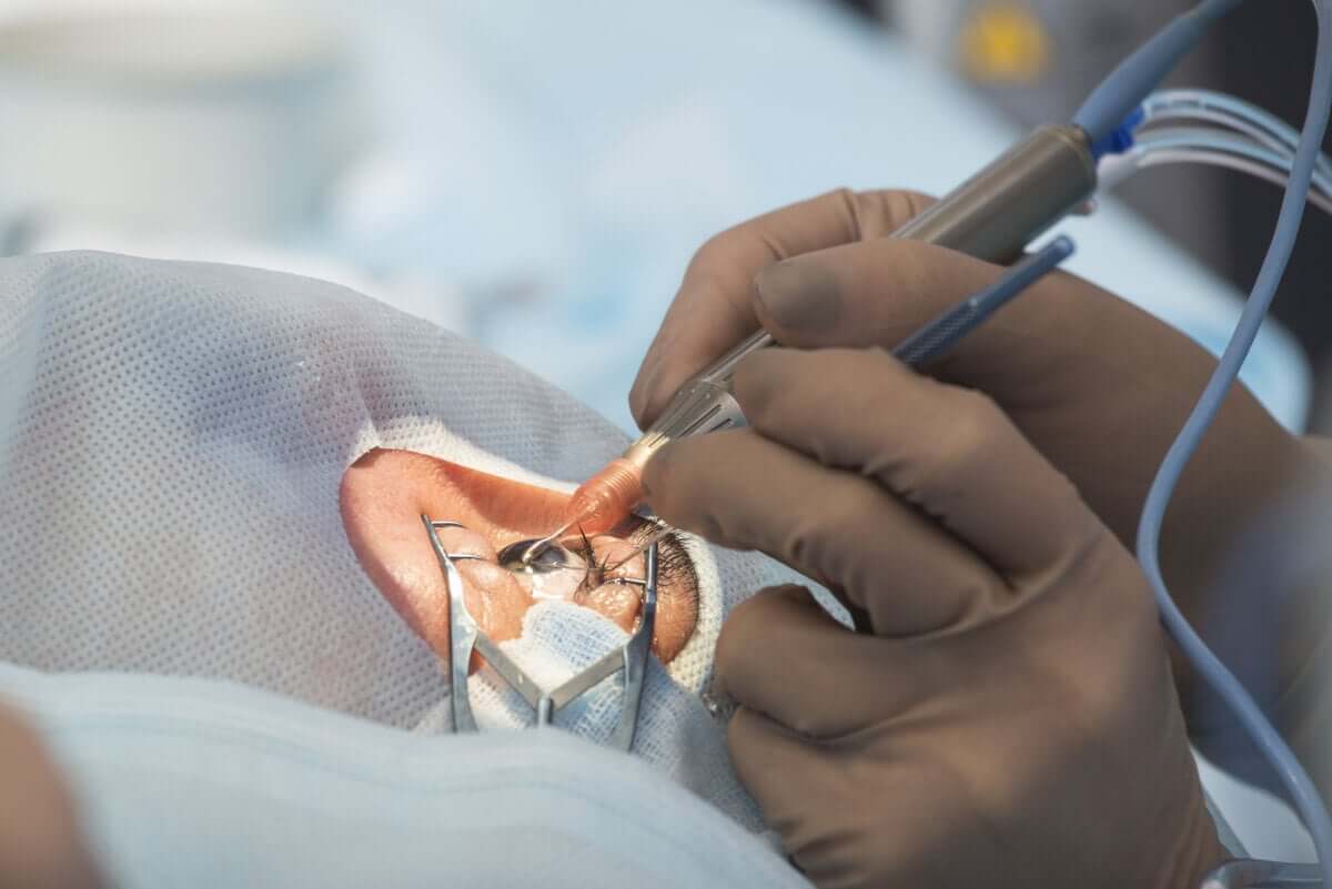 La chirurgie oculaire.