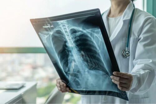 La tuberculose pulmonaire.