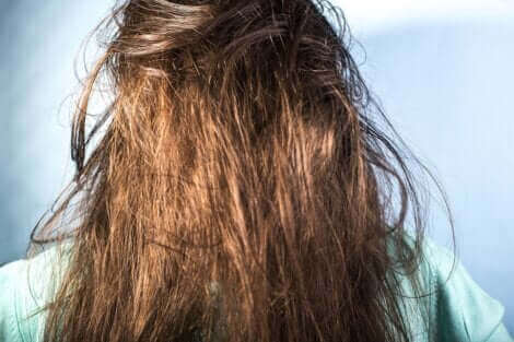 Une femme avec les cheveux gras.
