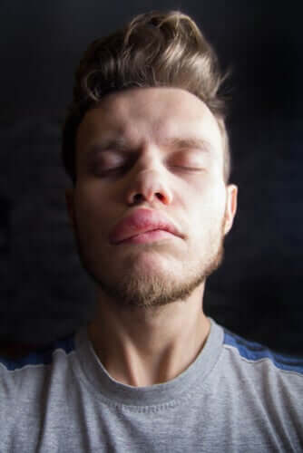 Causes et symptômes de l'oedème de Quincke