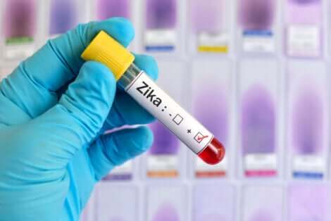 Le virus zika.