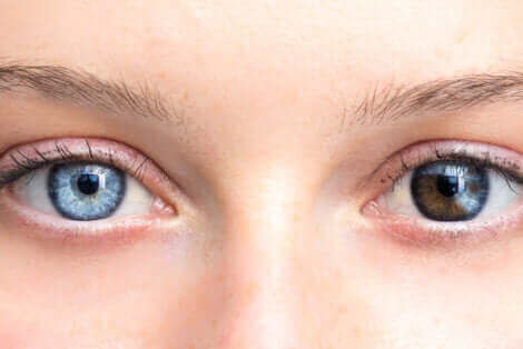 Des yeux de couleur différente.