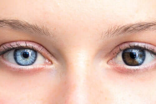 Changements de la couleur des yeux, est-ce inquiétant ?