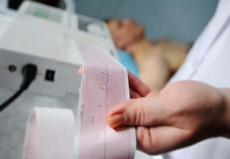 Un électrocardiogramme dans les mains d'un médecin.