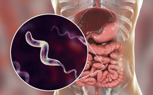 Infections à Campylobacter : ce qu'il faut savoir