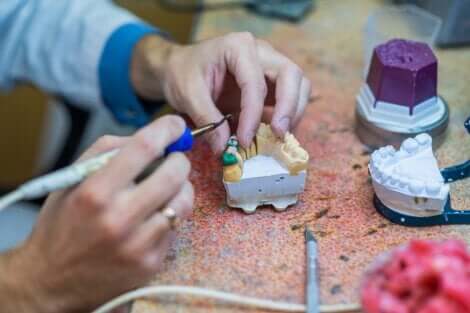 Un odontologue avec un bridge dentaire.