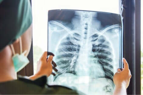 Radiographie des poumons.