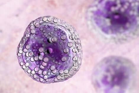Des cellules de lymphome.