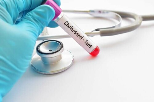 Quel est le niveau adéquat de cholestérol ?