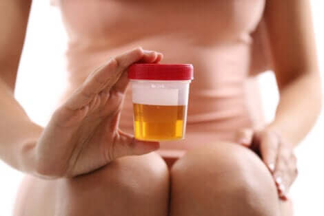 Un échantillon d'urine d'une femme.