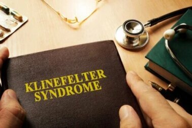 Qu'est-ce que le syndrome de Klinefelter et comment affecte-t-il les hommes ?