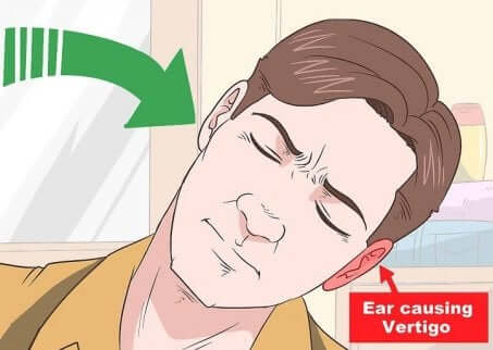 Un vertige postural.