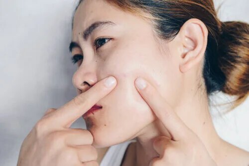 Comment le cycle menstruel affecte-t-il la peau ?