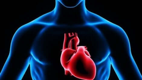 Insuffisance cardiaque chez une personne.