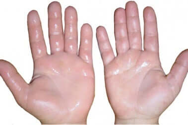 La transpiration des mains.