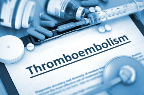 Qu'est-ce qu'une thromboembolie ?