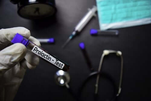 Les valeurs normales de la prolactine et pourquoi elle peut s'altérer