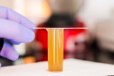 analyse de la matière fécale pour la strongyloïdose