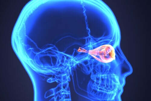 Neuromyélite optique ou maladie de Devic : de quoi s'agit-il ?