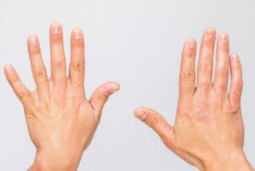 Les maladies auto-inflammatoires