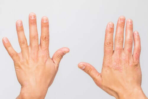 Les maladies auto-inflammatoires