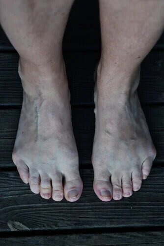 Qu'est-ce qu'un oignon du tailleur ?