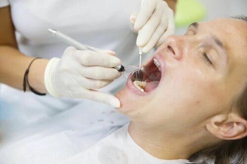 Une patiente qui se fait poser des facettes dentaires.