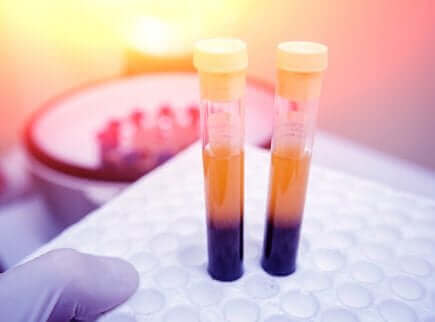 Des analyses de sang.