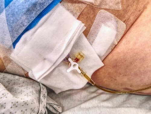 Recommandations pour les personnes avec une stomie