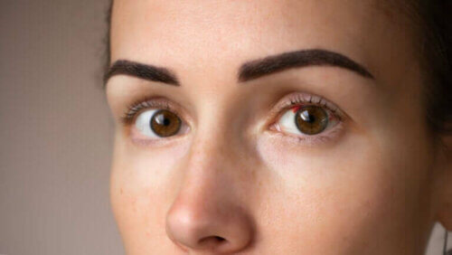 Taches rouges sur les yeux : pourquoi se produisent-elles ?