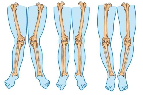 Les types de jambes.