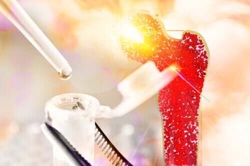 Aplasie médullaire : tout ce que vous devez savoir