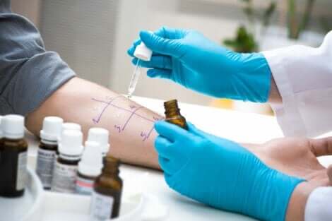 Test cutané pour les allergies.
