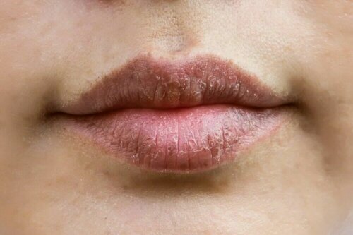 Des lèvres sèches ayant besoin de soin.