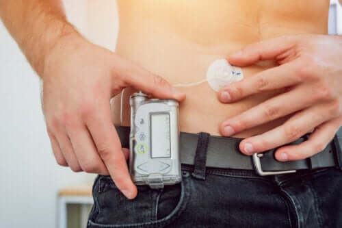 Qu'est-ce qu'une pompe à insuline ?