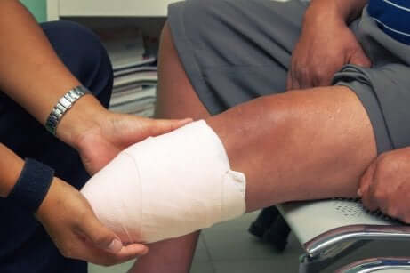 Une amputation d'une jambe.