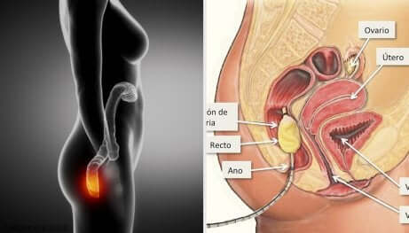 Anatomie du rectum.