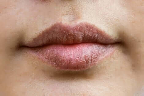 Les lèvres sèchent d'une femme.